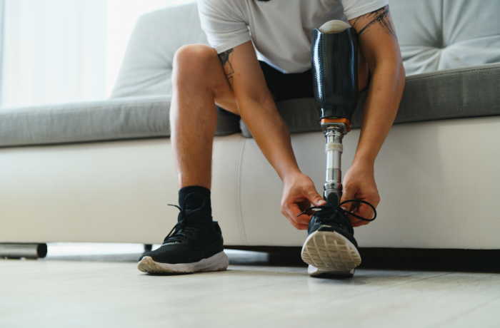 Man amputee with prosthetic leg disability on above knee transfemoral leg prosthesis wearing shoe sitting on sofa